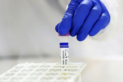 16/06/2020 Procesadr de muestras de coronavirus en Chile POLITICA SUDAMÉRICA INTERNACIONAL CHILE AGENCIA UNO/ CDUARTE 
